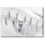 Diş Protezleri: Sağlıklı Gülümsemelerin Destekçisi Kanvas Tablo - 50 X 70