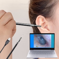 Kulak Temizleme Aracı Kaşık Hd Kamera Aracı Usb Tipi C Soket Win Kulak Temizleme Aracı Kaşık Hd Kamera Aracı Usb Tipi C Soket Win