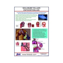 Solunum Yolları Enfeksiyonları Eğitim Plakası