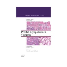 Biyopsilerin Yorumu: Prostat- Nobel Tıp Kitabevleri