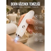 Znv Zenvia Mey İthalat 4 Başlıklı Pilli Vakumlu Siyah Nokta Temizleyici Akne Ve Sivilce Önleyici Znv2025 Cmn