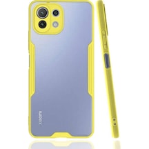 Xiaomi Mi 11 Lite Kilif Kamera Korumali Colorful Kapak 502111114
