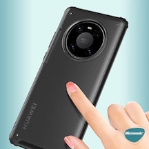 Xiaomi Mi 14 Ultra Kılıf Frosted Frame Siyah Mi 14 Ultra İle Uyumlu Kılıf - Siyah 50 x 22