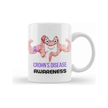 Crohn's & Colıtıs Awareness Warrior Unbreakable Kupa Bardak Porselen No11295 Karışık