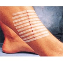 3M Steri-Strip R1546 Dikiş Bandı 6 x 100 MM 10 Adet