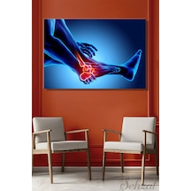 Yatay Tekli Kanvas Duvar Tablosu Modern Klinik Hastane Doktor Röntgen Film Ayak Bilek Ağrı 3d İş