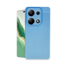 Note 13 Pro 4g Kılıf Auto Focus Kapak - Mavi