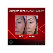 Göz Altı Torbalarına Karşı Etkili Göz Kremi 15 Ml