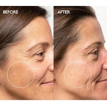 Beyazlatıcı Etkili Leke Karşıtı Bakım Kremi Arbutin Yüzde İki Brightening Krem 50ml