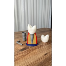 İmplant Modeli Diş Hekimliği Eğitici Model 13 CM