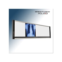 İnce Dörtlü Negatoskop X Ray Film Viewer
