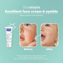Stelatopia Emollient Yüz Kremi 40ml