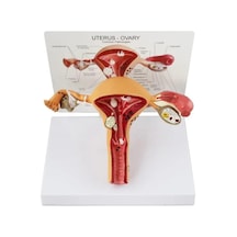Uterus Pelvik Taban Maketi Model 41