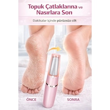 Softpedi Elektrikli Topuk Temizleyici Şarjlı Ayak Törpüsü, Ölü Deri Giderici, 2 Yedek Başlıklı, Topuk Çatlak Giderici Pedikür Cihazı