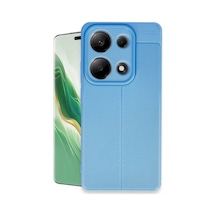 Newface Xiaomi Redmi Note 13 Pro 4g Kılıf Auto Focus Kapak - Mavi Çok Renkli