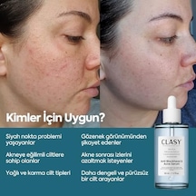 Niacinamide Yüz Serumu Gözenek Görünümünü Sıkılaştırmaya Ve Yağ Dengesini Desteklemeye Yardımcı Siyah Nokta & Leke Görünümü İçin Aydınlatıcı Bakım Serumu, 50 Ml