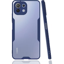 Uryport Xiaomi Mi 11 Lite Kılıf Platin Silikon - Lacivert