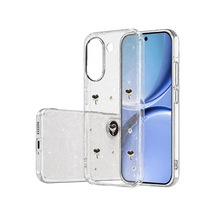 Newface - 534 - Xiaomi Poco X8 Pro Fiyonk Desenli Kapak - - Ece-umay - Desen 1