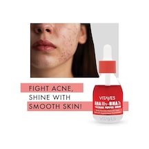 Vıtayes Aha%10 Bha%2 Kırmızı Peeling Cilt Serumu - Gözenek Sıkılaştırıcı, Cilt Canlandırıcı, Yenileyici, Ton Eşitleyici, Arındırıcı, Siyah Nokta Ve Akne Karşıtı, Anti-aging, Yaşlanma Karşıtı 30 Ml