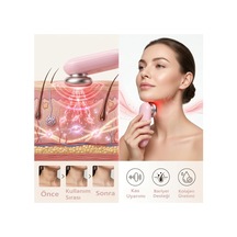 A07 Rf Ems Yüz Masaj Aleti, Cilt Sıkılaştırıcı, Pembe