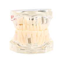 Samdoo Diş Sağlığı Eğitim Modeli: Şeffaf, Ayrılabilir Mandibula Ve Maksila - Diş Yapısı Ve İmplantasyon Öğretimi Çok Renkli