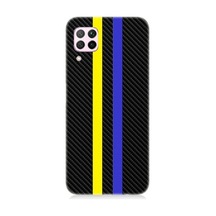 Huawei P40 Lite Uyumlu Sarı Lacivert Karbon Motif Desenli Silikon Kılıf