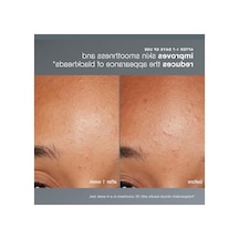 Günlük Mikrofolyant 13g, Cilt Yenileyici Peeling