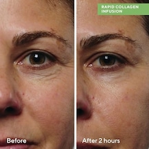 Murad Collagen Infusion Anında Sıkılaştırıcı Kolajen Serumu 30 Ml