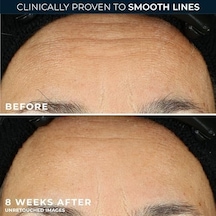 Roc Retinol Correxion Smoothing Kırışıklık Karşıtı Kapsül Serum 10 Adet
