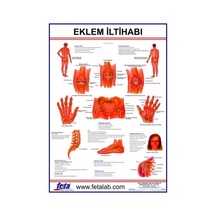 Eklem Iltihabı Levhası