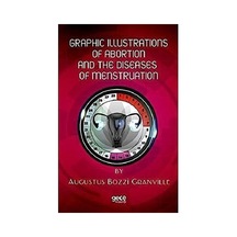 Graphic Illustrations Of Abortion And The Diseases Of Menstruation