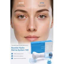 Hydra Derma System 140 Microneedling Serum Applicator 140 İğneli Hydra Needle Cilt Bakım Kalemi Anti Aging Gözenek Sıkılaştırıcı Serum Uygulama Cihazı