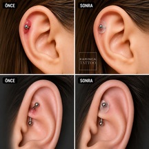 Piercing Keloid Diski Bump Piercing Yara Önleyici Bioplast 10 Adet çok renkli