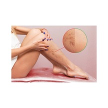 Spıder Veins Defense Cream Selülit Diz 120 Ml X 2 Adet