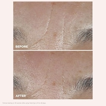 Total Eye Lift Göz Kremi 15 Ml