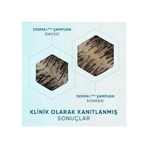 & Shoulders Dermaxpro Yatıştırıcı Kepek Karşıtı Şampuan Kuru Ve Kaşıntılı Saç Derisi İçin 300 Ml