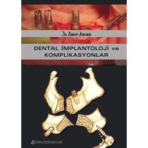 Dental İmplantoloji ve Komplikasyonlar- Nobel Tıp Kitabevleri