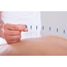 Medikaltec Akupunktur Iğnesikuru Iğne,acupuncture Needle 0.25 25mm