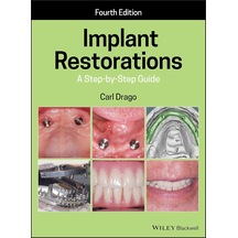 Implant Restorations: A Step By Step Guide