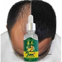 7days 30ml Gingergerminalessentialoil Hair Growth Loss Treatment Serum Unisex 3 Adet Saç Bakım Yağı