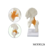Kalça Eklemi Maketi Model 24
