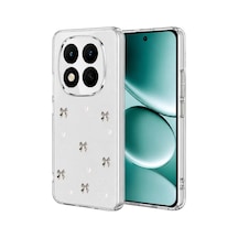Mey İthalat Redmi Note 15 Pro 4g Fiyonk Desenli Kapak - Desen 8