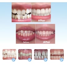 Çocuk Diş Silikon Ortodontik Parantez 3 Lü Set D1 D2 D3 Şeffaf