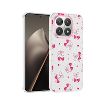 Xiaomi 15t Kılıf Çiçek Ve Fiyonk Desenli Kamera Yükseltili Pazarplus Premium Diğer