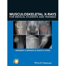 Musculoskeletal X-rays For Medical Students And Trainees