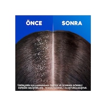 Shoulders Kadınlara Özel 330 Ml Saç Dökülmesine Karşı Kepek Şampuanı Beyaz