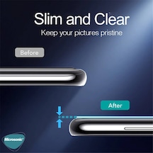 Microsonic Honor Magic 8 Lite Kamera Lens Koruma Camı Siyah