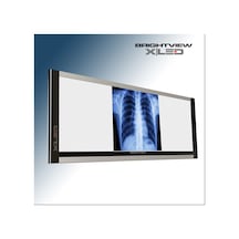 İnce Üçlü Negatoskop X Ray Film Viewer