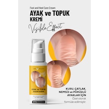 Ayak Ve Topuk Çatlak Bakım Kremi 100 Ml Kuru, Sertleşmiş Ve Pürüzlü Ayaklar İçin
