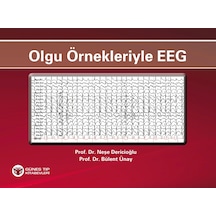 Olgu Örnekleriyle Eeg